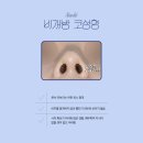 노즈랩의원 이미지