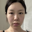 엘프귀필러후기 #귀잘보이게 하는 내돈내산 귀필러