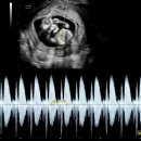 서리풀성모여성의원 이미지