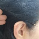 시그니아독일보청기도봉센터 이미지