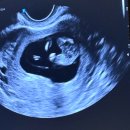 성별식당 | 과연 쌍둥이의 성별은? | 베스킨라빈스 젠더리빌편 to 남편