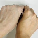 라온메디케어 이미지