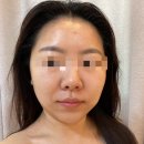 더씨온에스테틱 네이버블로그