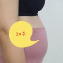 꽁이몰 | 현대해상 태아보험 만기 30세 추천 (현금 페이백)