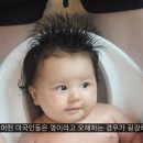 몽고반점 이미지