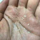 자연앤약국 | 헤드앤숄더비듬샴푸까지 써봤는데 + 후기