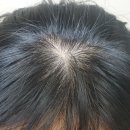 헤어플러스 티스토리
