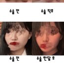 서울퀸성형외과의원 이미지