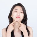 성모라인성형외과의원 네이버블로그