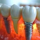 열린오치과의원 이미지