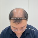 채움아카데미 | 광주두피문신잘하는곳 찾는다면, "유명함" 보다는 이것부터 확인하세요