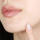 고민 부위 집중 케어를 위한 리르 스피큘 스팟 세럼 후기