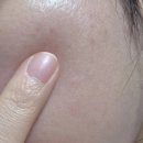 패드야 | 트러블 방지 베개커버 아크넨 패드 후기 사용법