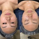 광주피부관리 글리나뷰티, 신부관리에서 피부관리까지, 내 아름다움을 완성