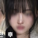 서울퀸성형외과의원 이미지