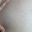 정케어 | 솔에스테틱 김포구래점 등진정케어 후기