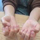 힐링네일 이미지