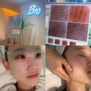 코압빌딩 | 대구모공 케어 잘하는 곳 비텐에스테틱에서 피부관리 받은 후기