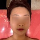 동탄영천동피부관리 애플페이스 skin&amp;body 플라즈마로 진정재생된 후기