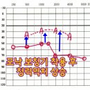 굿모닝보청기(경북대병원점) | 대구 경대병원앞 위치 포낙 귓속형 보청기 착용 후기!