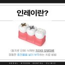 보일치과기공소 이미지