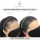 헤어라인 이미지