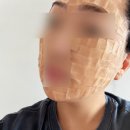 연세보드미의원 네이버블로그