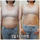 홍여우 - 광주시 | 유사나헬스팩 고민하다 결정한 3일 디톡스 단식 5키로감량 후기