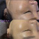 아띠랑스뷰티