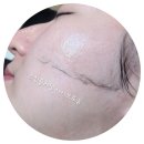 플래닝 짐(Planning Gym) | 순천 피부관리 스캔플래닝으로 피부톤 업!