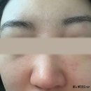 나이아신아마이드 &amp; 살리실산? 민감 수부지 피부가 실험해본 1일차 토너 사용 후기 [feat.딕셔니스트 토너]