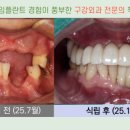치아룸 치과기공소 이미지