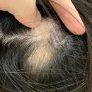 헤어온의원 이미지