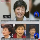 &#39;세월호 7시간&#39; 박근혜 대통령 성형수술 의혹…전문의 견해 보니 &#34;상안검·하안검·미스코 했다&#34; 이미지