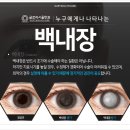 글로리서울안과의원 이미지