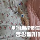 찬스신경과의원 | 병상일지 1 : 누우면 괜찮고 일어서면 극심한 두통 자발성 두개내압저하증