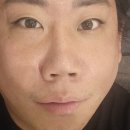 리앤델의원 | 압구정로데오 리앤델클리닉 수면 리쥬베룩 시술 후기