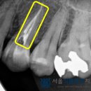 서울식플란트치과의원 이미지