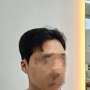도레브헤어 이미지