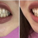 덴탈스파치과의원 이미지