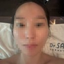 성산구 ⓒ-14 | 상암동피부관리 추천 로이에스테틱 성산점 후기