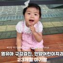 안양어린이치과 개구장이치과 23개월 영유아검진이랑 불소도포 받고왔어요