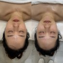 수원 윤곽관리 에스테틱 다리아 수원본점에서 받고온 신부관리 후기