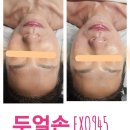 미고 테라피 이미지