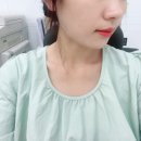 민위멍 | 대전리투오 후기 내돈내산, 일상 바로 복귀 통증 덜해서 신기방기