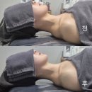 한울컴퓨터 | 전주 에코시티 신부관리 추천 🌿 한울에스테틱 웨딩케어 후기 1회차