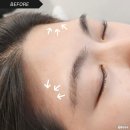 [강서구] 저자극 저통증 헤어라인 관리 화곡역왁싱 &#39;선샤인왁싱 화곡점&#39;