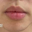 리유 이미지