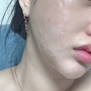 (주)엔디에스 | [공구] 특허받은 피부과 베스트 리프팅 2종 콜라보 ♥ 쏘큐 리프팅팩 + 닥터엔디에스 70% + 할인혜택!