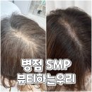 우리세탁 | 병점SMP 두피채움 커버 잘하는 곳 뷰티하는우리 1~3주차 후기